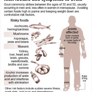 Does Shrimp Have Purines - A Gout Treatment Can Also Mean A Treatment For Arthritis